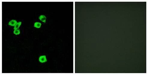 RPS6KC1 Antibody