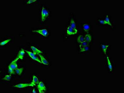 RPTOR Antibody