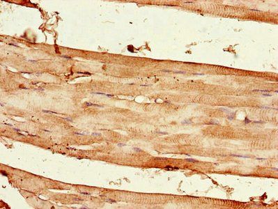 RPTOR Antibody