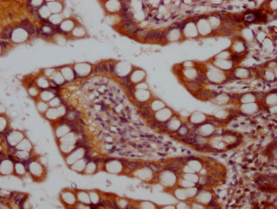 RPTOR Recombinant Monoclonal Antibody
