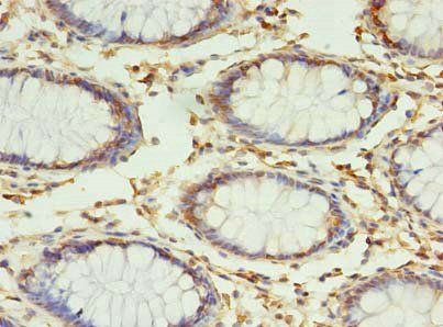 RPUSD4 Antibody