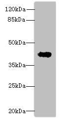 RPUSD4 antibody