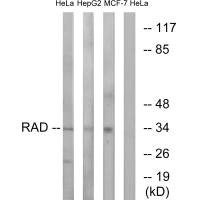 RRAD Antibody