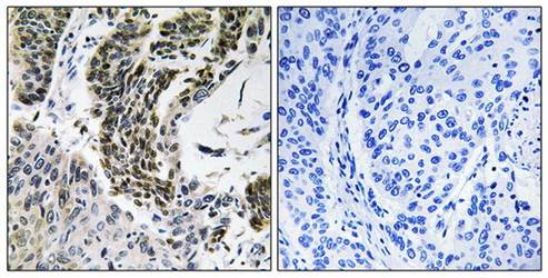 RREB1 Antibody