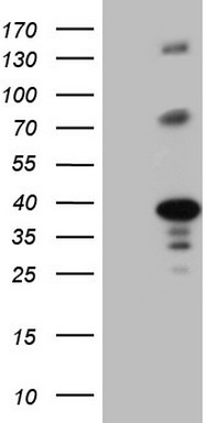 RRM1 Antibody