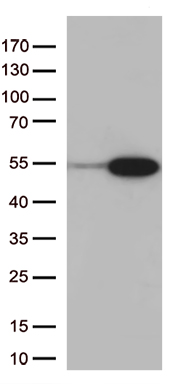 RRM1 Antibody