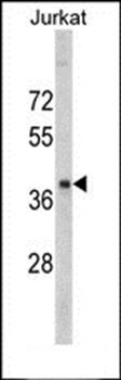 RRM2 antibody