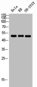 RRS1 Antibody