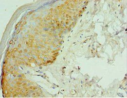 RSAD2 Antibody