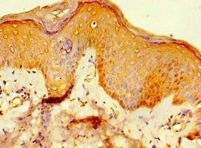 RSAD2 Antibody