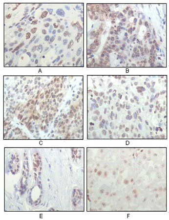 RSK1 Antibody