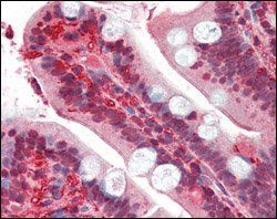 RSK1 Antibody