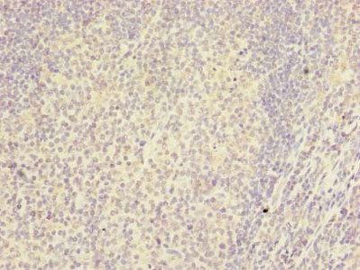 RSPH14 Antibody