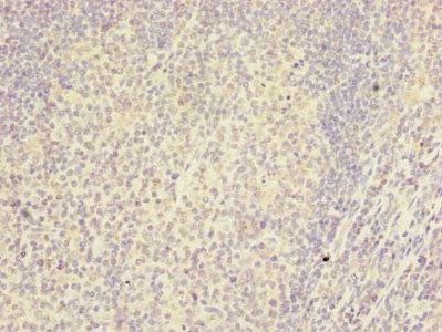 RSPH14 antibody