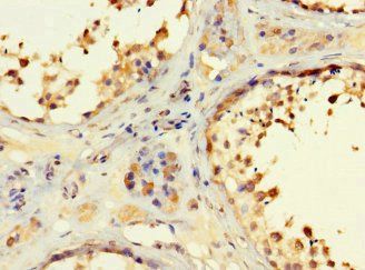 RSPH9 Antibody