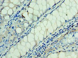 RSPO1 Antibody