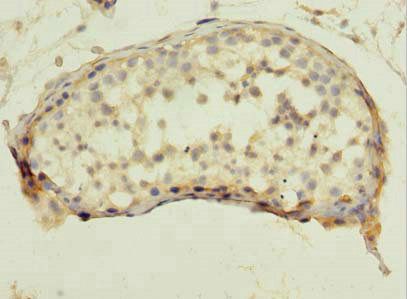 QTRT1 Antibody