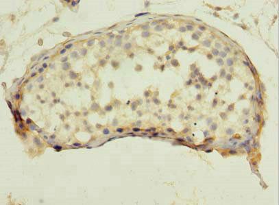 RSPO3 antibody