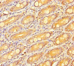 RSPO3 Antibody