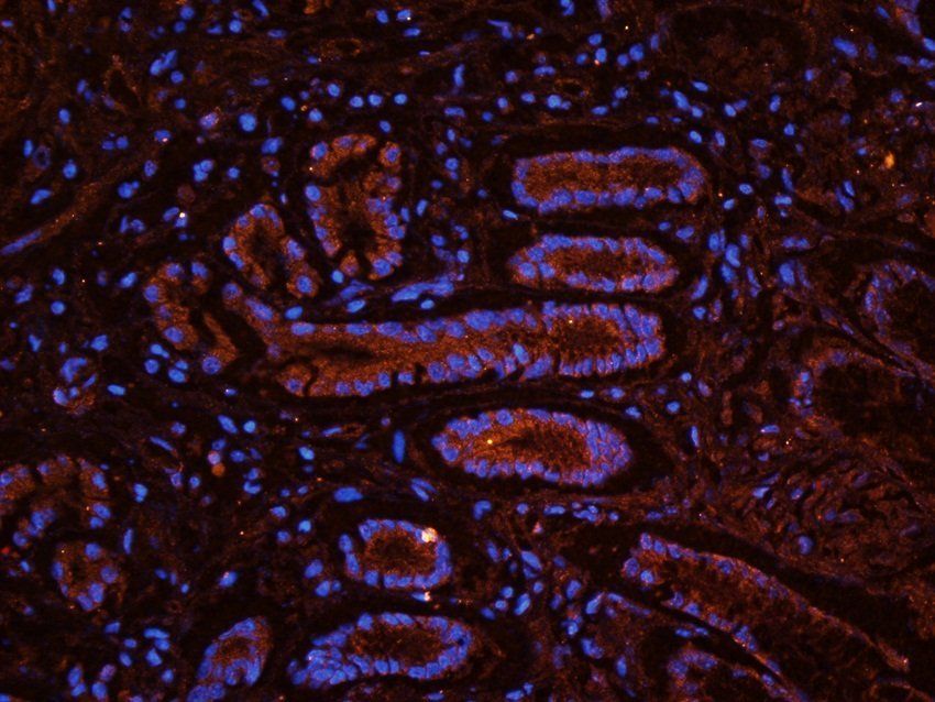 RSPO3 antibody