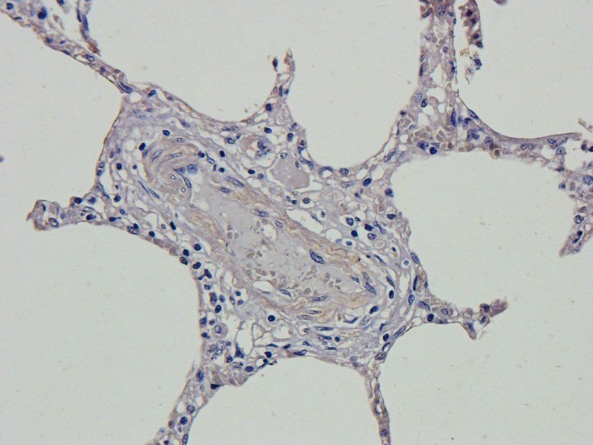 RSPO3 antibody