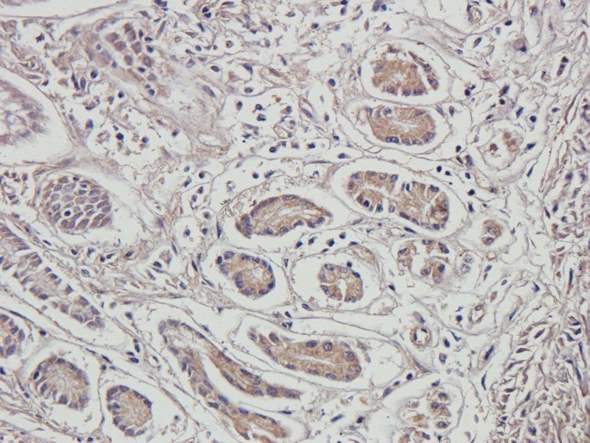 RSPO3 antibody