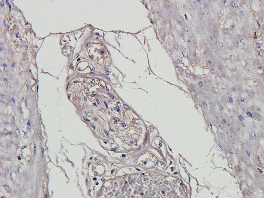 RSPO3 antibody