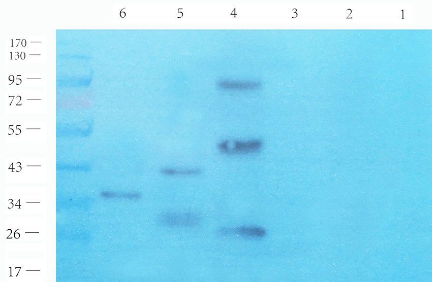 RSPO3 antibody