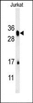 RSPO4 antibody