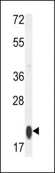 RT25 antibody