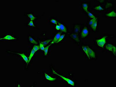 RTCB antibody