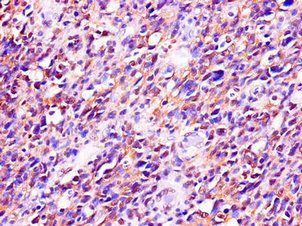 RTCB Antibody