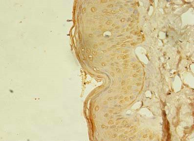 RTKN2 antibody