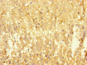 RTN4IP1 antibody