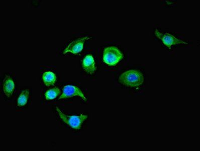 RTN4RL1 antibody