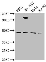 RTN4RL2 antibody