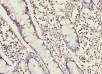 RUFY1 Antibody
