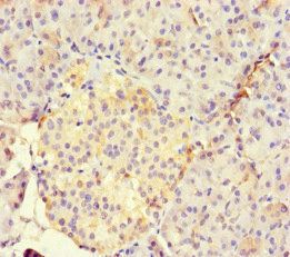 RUNX1T1 Antibody
