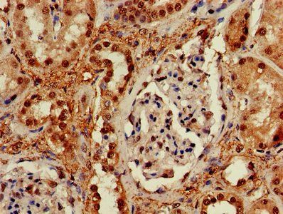 RUVBL2 Antibody