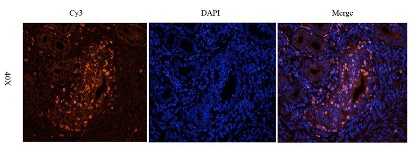 RYR2 antibody