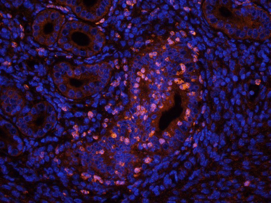 RYR2 antibody