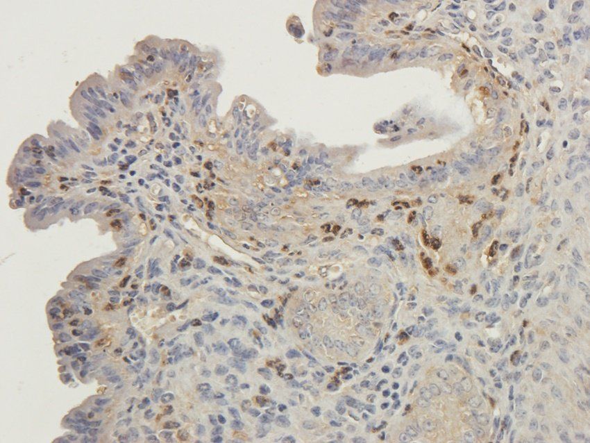 RYR2 antibody