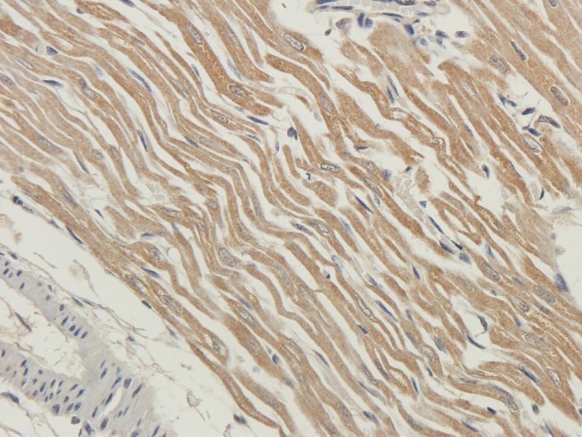 RYR2 antibody