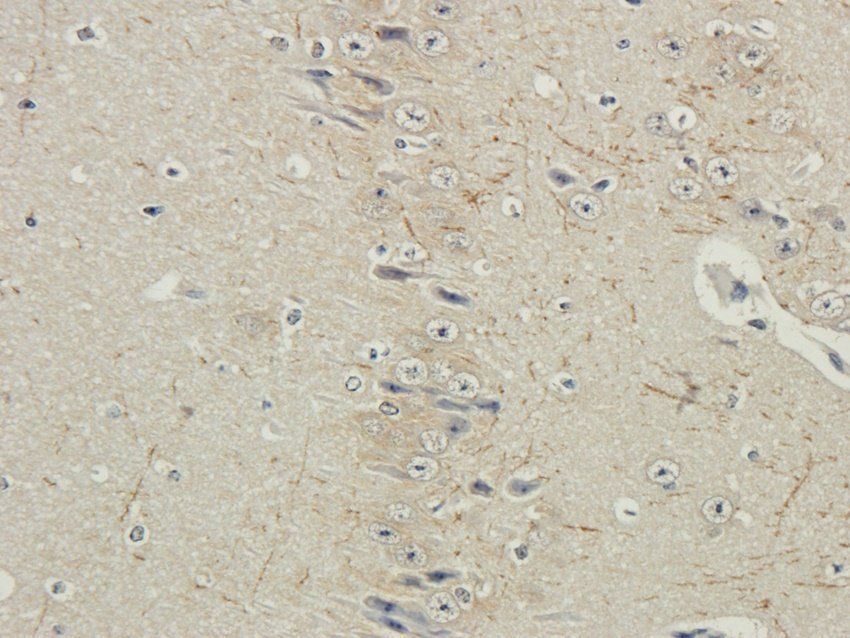 RYR2 antibody