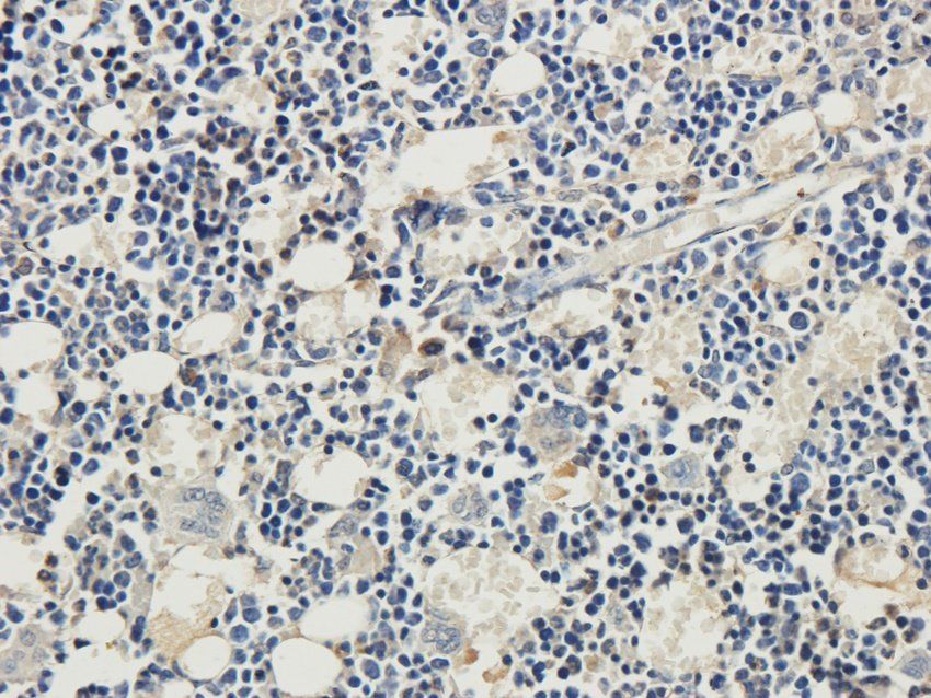 RYR2 antibody