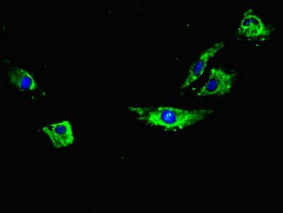 RYR2 Antibody