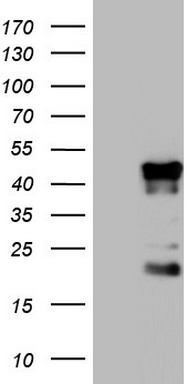 S100 beta Antibody