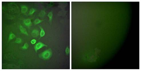 S100A1 antibody