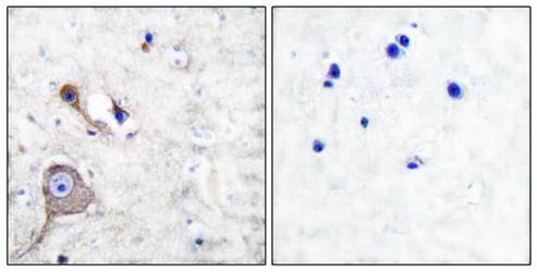 S100 A1 Antibody