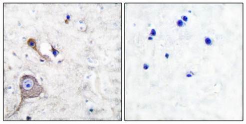 S100A1 antibody